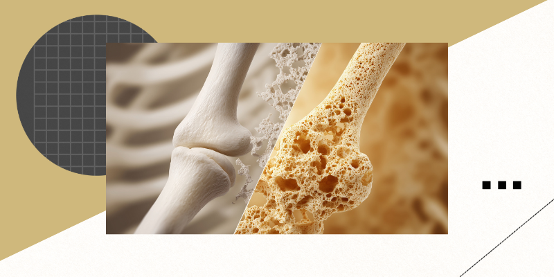 tirzepatide bone loss Do anti-obesity medications affect bone health?